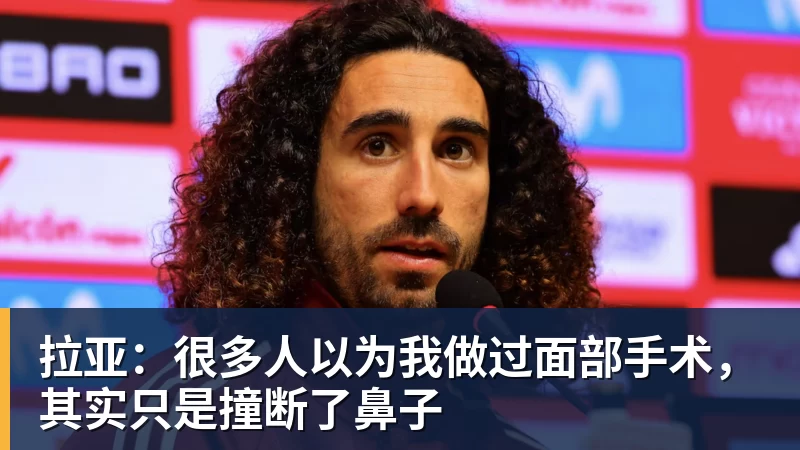 拉亚：很多人以为我做过面部手术，其实只是撞断了鼻子